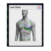 Ie6 BIOCARE,STANDARD VERSION,6-CHANNEL,IEC,V1.0